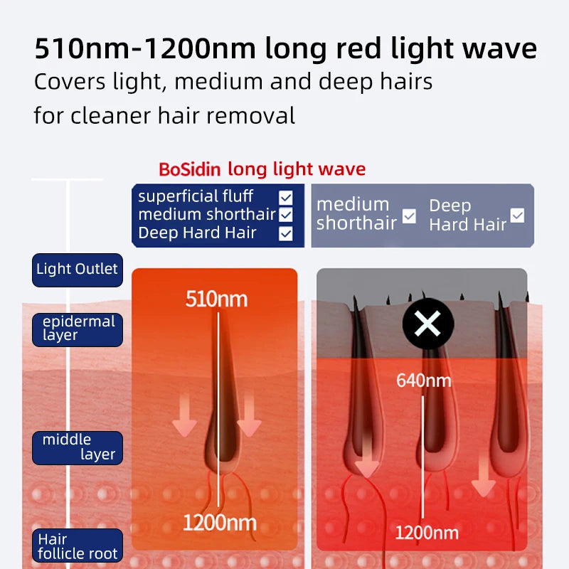 Bosidin جهاز الليزر لازالة الشعر من